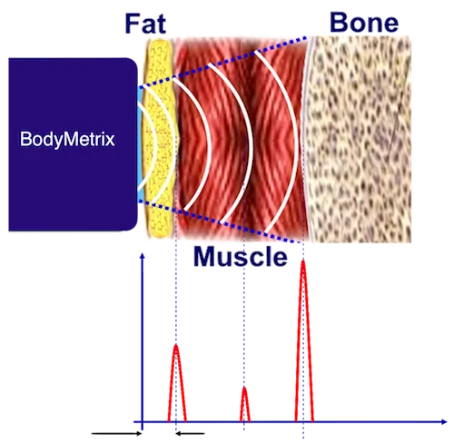 4 BODYMETRIX.webp